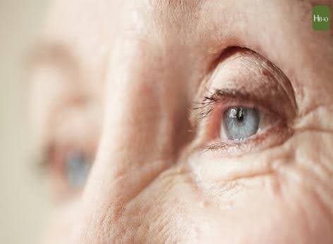 運動讓眼睛不老化，降白內障風險